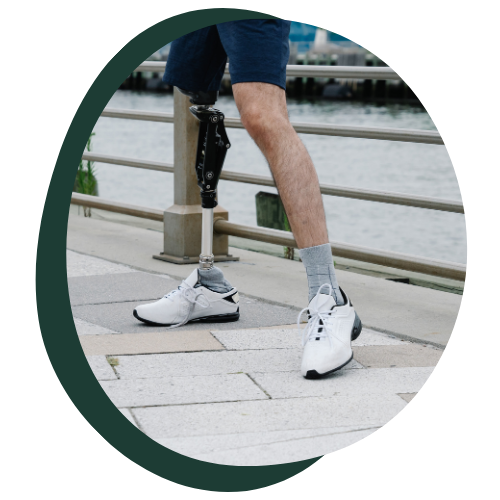 A close-up image of a man with a prosthetic leg in shorts and tennis shoes stretching. 